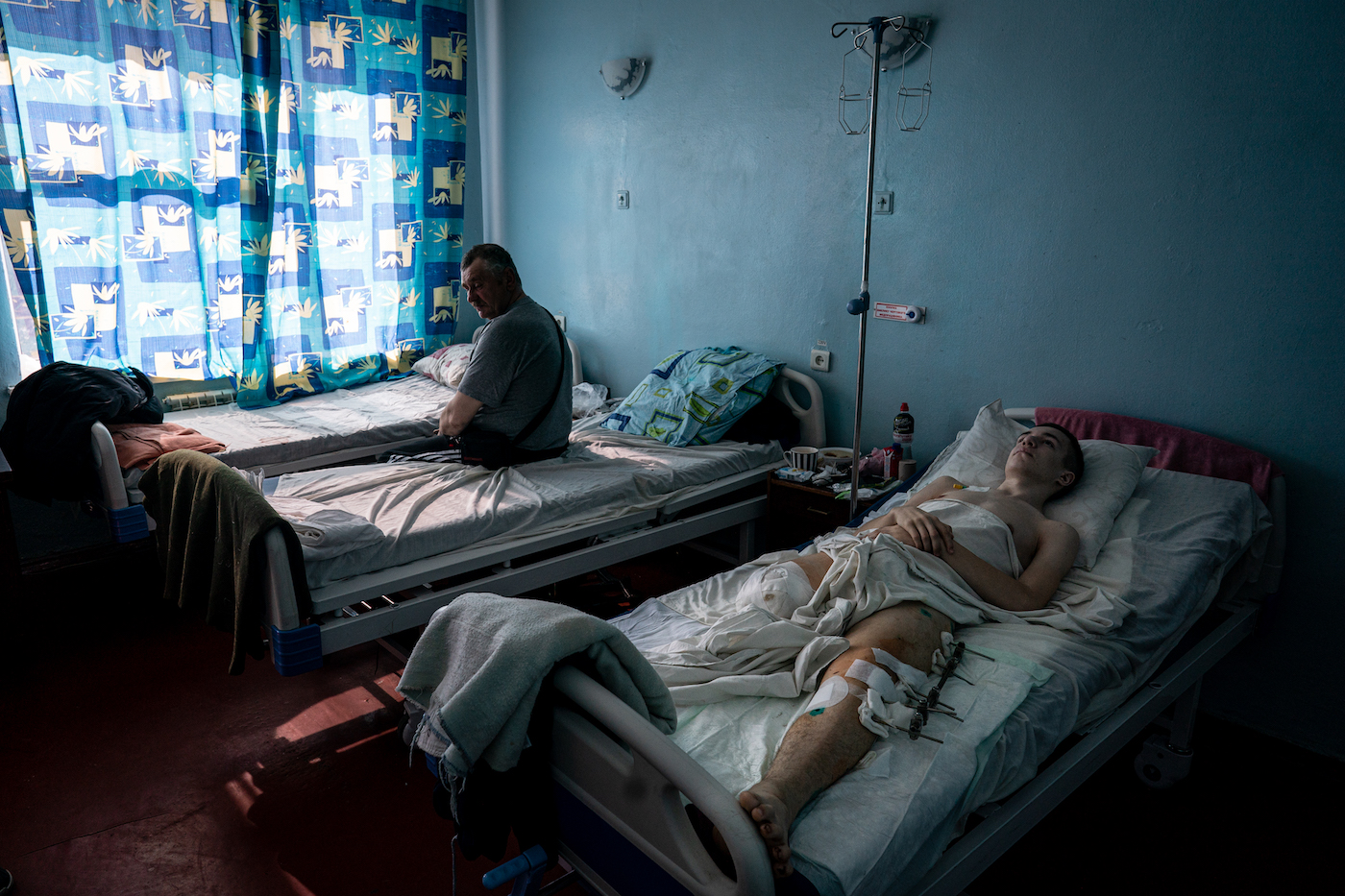 Sasha, 16, is seen laying in a hospital bed after having his leg amputated following an injury from Russian shelling. Prior to the war Sasha’s passion was dancing. Kharkiv, Ukraine on March 11, 2022 Wolfgang Schwan - Anadolu Agency